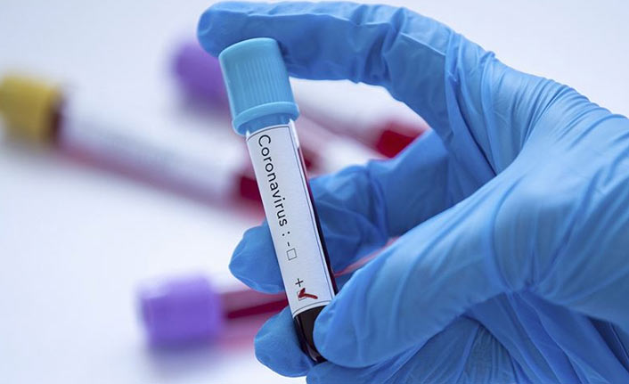 Türkiye’de 20 bin 33 yeni vaka, 187 kişi hayatını kaybetti