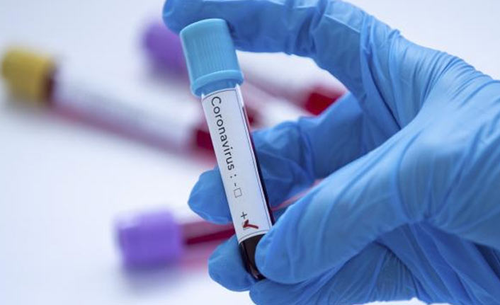 Türkiye’de 20 bin 33 yeni vaka, 187 kişi hayatını kaybetti