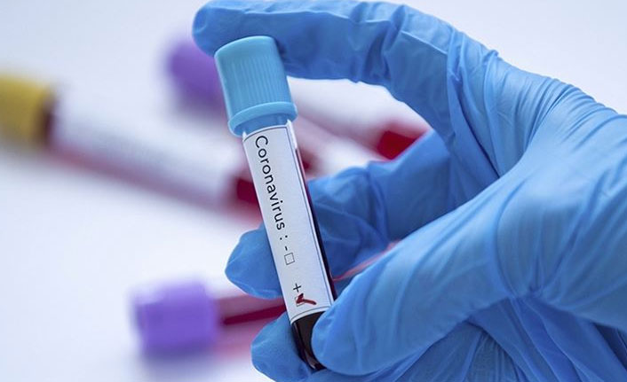 Türkiye’de son 24 saatte 19 bin 696 yeni vaka tespit edildi