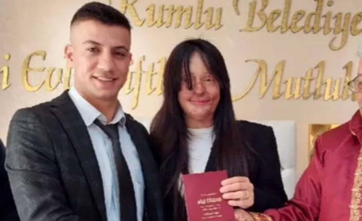 Berfin Özek yüzüne asit atan sevgilisiyle evlendi!