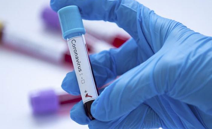 Türkiye’de 24 saatte 18 bin 796 yeni Kovid-19 vakası