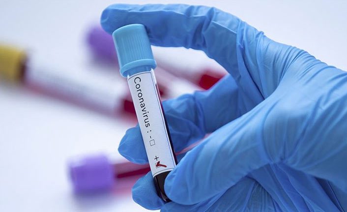 Türkiye’de son 24 saatte 21 bin 477 yeni vaka