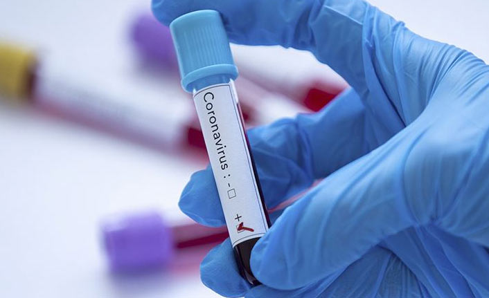 Türkiye’de 24 saatte 19 bin 859 yeni Kovid-19 vakası