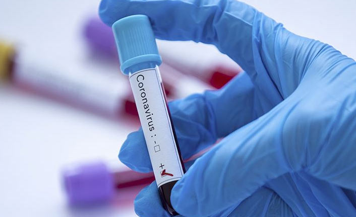 Türkiye’de 18 bin 910 yeni Kovid-19 vakası tespit edildi