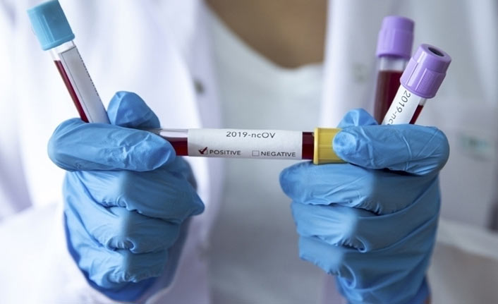 Türkiye’de 36 bin 731 yeni vaka, 145 can kaybı