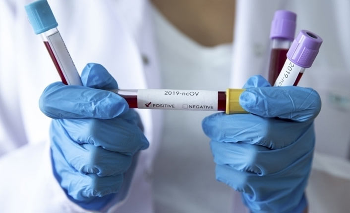 Vaka sayıları uçuyor! Türkiye'nin günlük koronavirüs ve aşı tablosu açıklandı - 05 Ocak 2022 Çarşamba