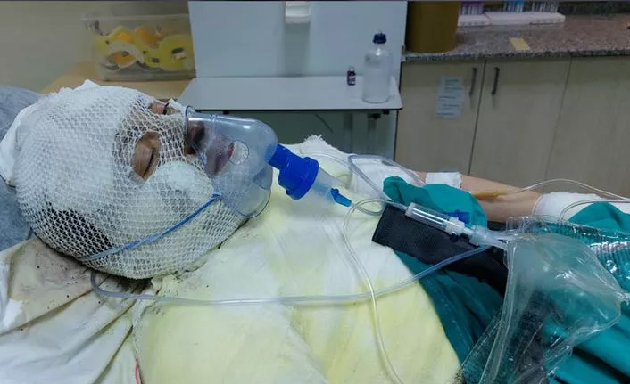 Eski eşi Elvan Sözkesen’i yakan cani konuştu