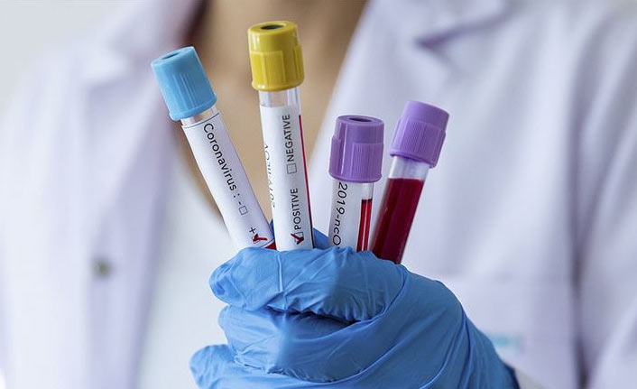 Türkiye’de son 24 saatte 67 bin 857 yeni Kovid-19 vakası tespit edildi