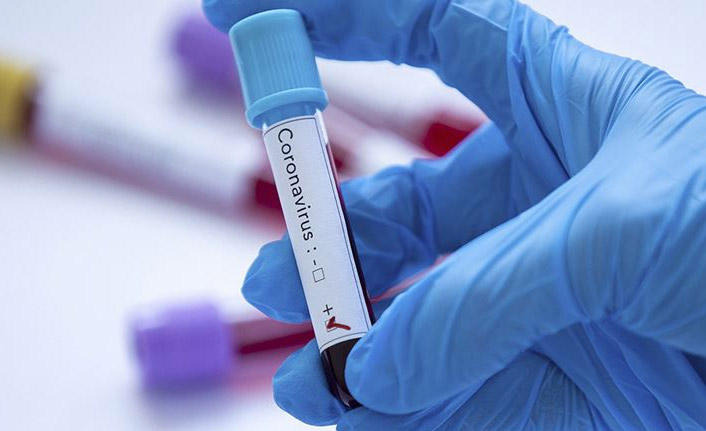 KTÜ'lü Bilim Kurulu Üyesinden önemli uyarı! "Sportif müsabakalar 'bulaş' riski taşıyor"