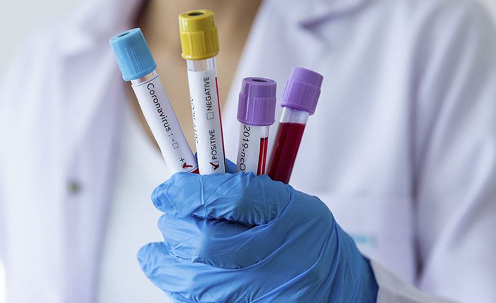 Türkiye’de son 24 saatte 54 bin 100 yeni Kovid-19 vakası