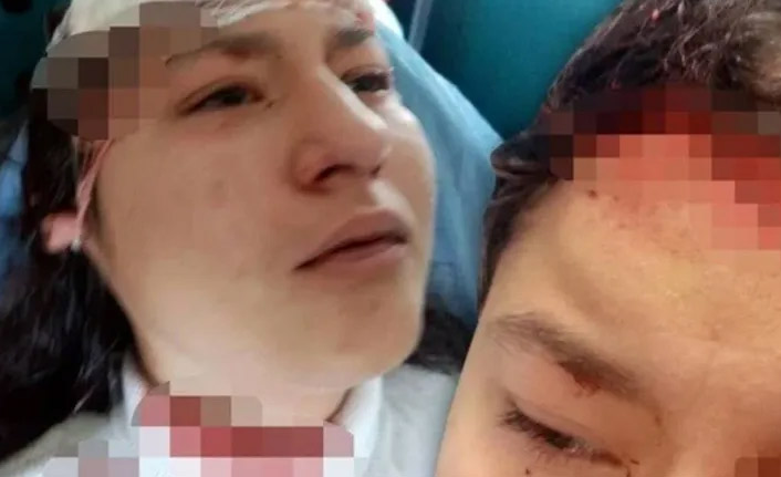 Selfie çeken 14 yaşındaki çocuğa 5 köpek saldırdı