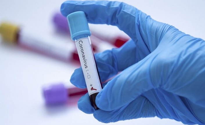 Türkiye’de 71 bin 843 yeni Kovid-19 vakası tespit edildi