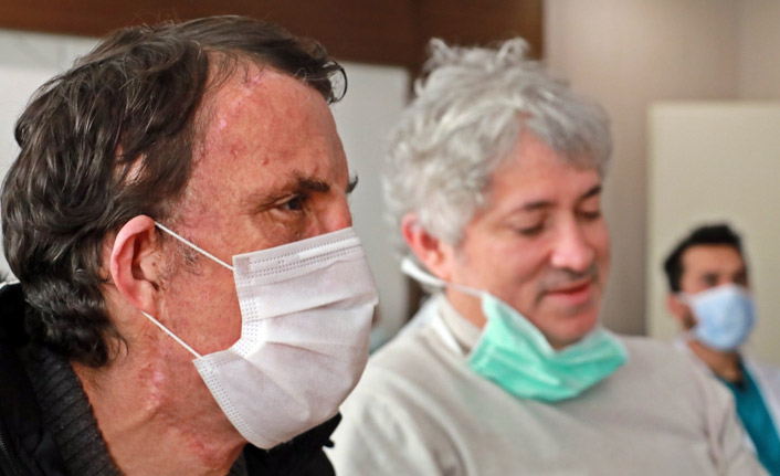 İşte ilk yüz nakli olan Uğur Acar'ın son hali