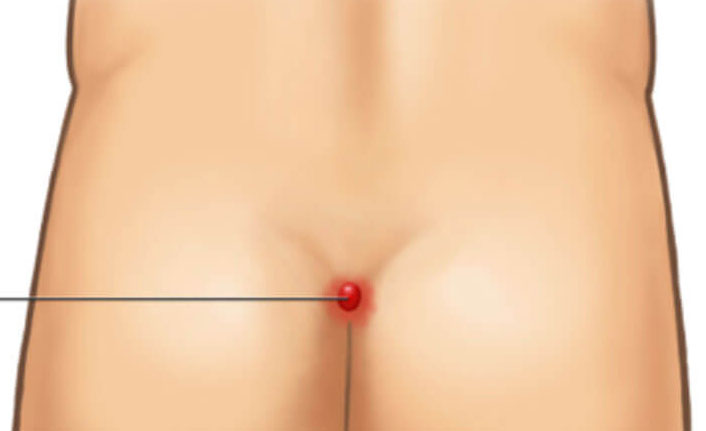 “Kıl dönmesi zamanında tedavi edilmezse enfeksiyon büyür”