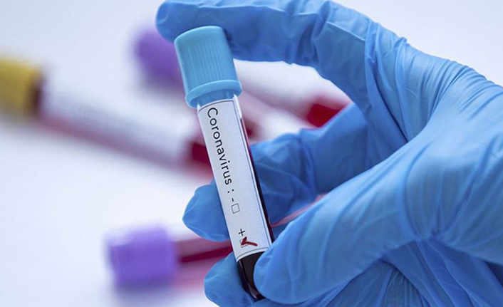 Türkiye’de son 24 saatte 77 bin 434 yeni Kovid-19 vakası