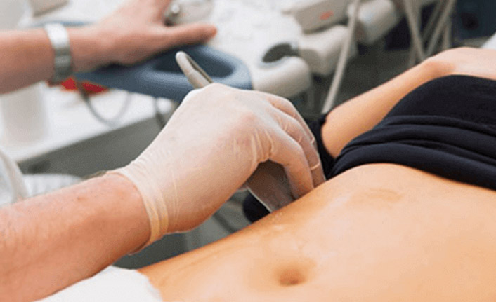 Labioplasti Neden Uygulanır?