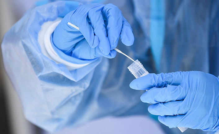 Akıllı telefon ile yapılabilen Covid-19 testi geliştirildi