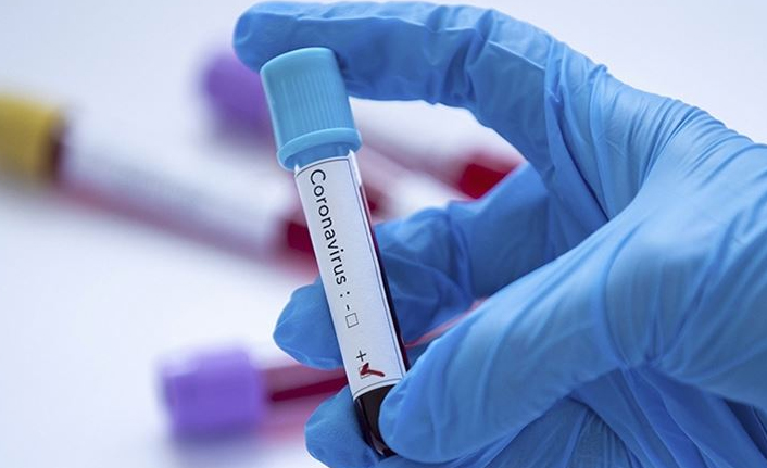 Türkiye’de günlük Kovid-19 vakası ilk kez 100 bini aştı