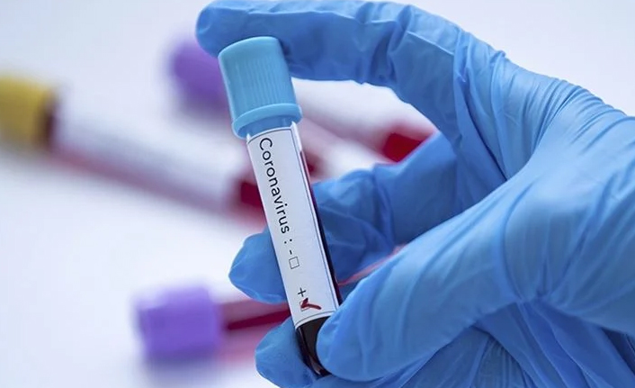 Türkiye’de 24 saatte 111 bin 157 yeni Kovid-19 vakası tespit edildi