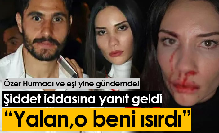 Özer Hurmacı eşinin şiddet iddiasına yanıt verdi: O beni ısırdı!