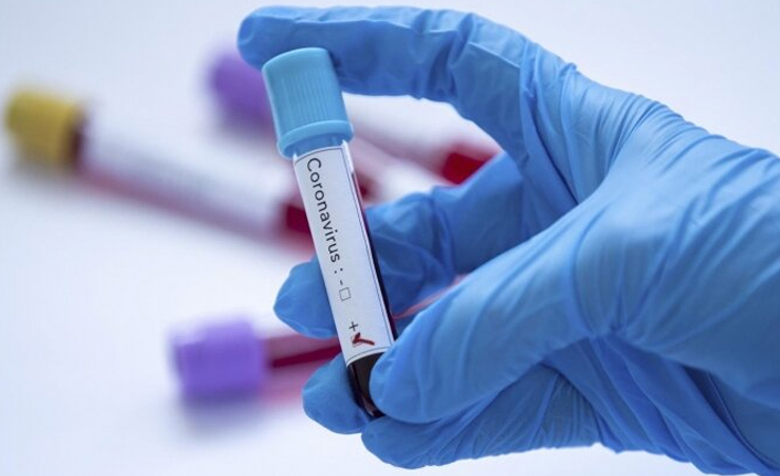 Türkiye’de 108 bin 563 yeni vaka tespit edildi: 266 kişi yaşamını yitirdi