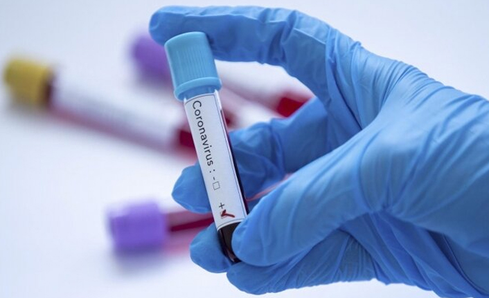 Türkiye’de 86 bin 193 yeni Kovid-19 vakası, 272 kişi hayatını kaybetti