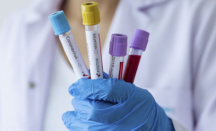 Türkiye’de son 24 saatte 94 bin 730 yeni Kovid-19 vakası