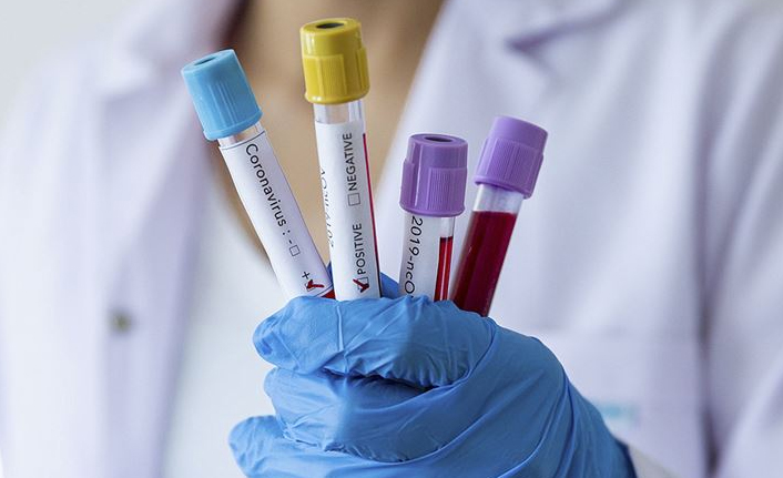 Türkiye’de 24 saatte 92 bin 406 yeni Kovid-19 vakası