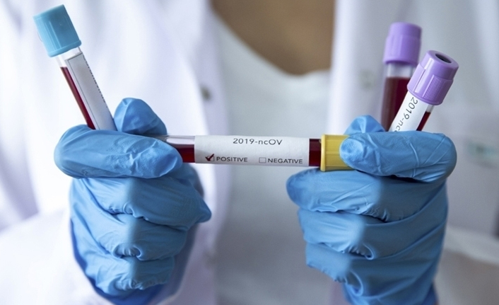 Türkiye’de son 24 saatte 80 bin 454 yeni Kovid-19 vakası