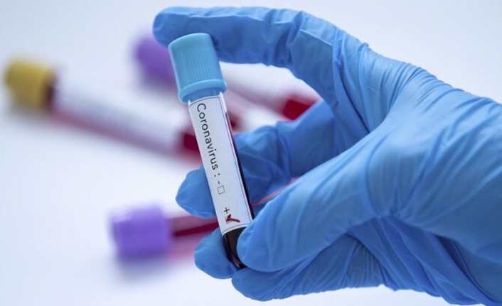 Türkiye’de 85 bin yeni Kovid-19 vakası: 268 kişi yaşamını yitirdi