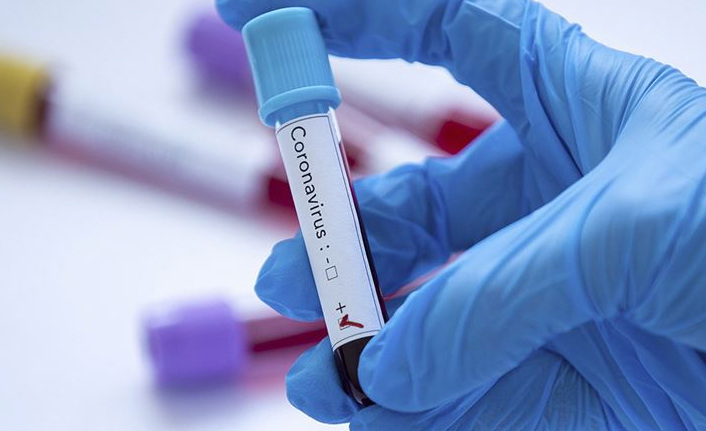 Türkiye’de 24 saatte 49 bin 792 yeni vaka, 206 can kaybı