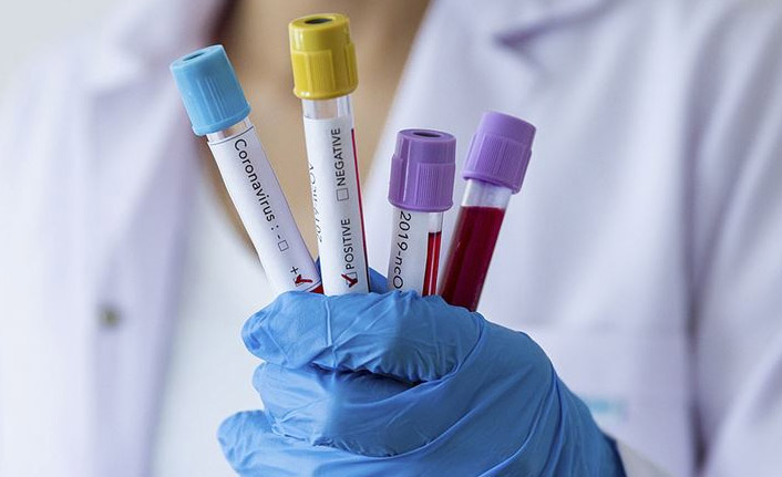 Türkiye'de 24 saatte 59 bin 885 yeni Kovid-19 vakası tespit edildi