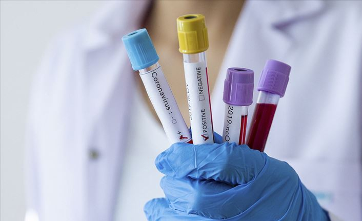 Türkiye'nin günlük koronavirüs ve aşı tablosu açıklandı - 04 Mart 2022 Cuma