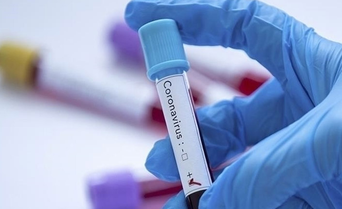 Türkiye'de son 24 saatte 27 bin 671 yeni Kovid-19 vakası