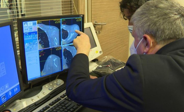 Kanser tedavisinde yeni yöntem! Kriyoablasyon