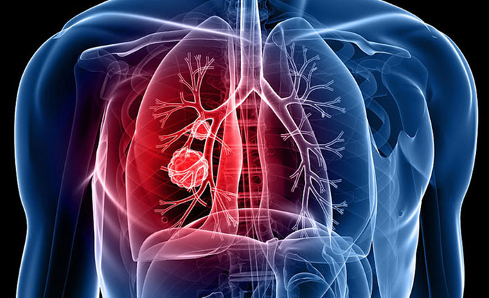 "Tüberkülozda erken tanı ve tedavi çok önemli"