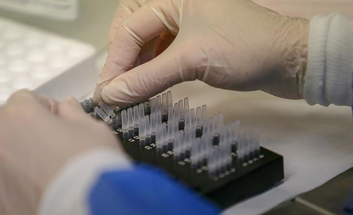 DSÖ'den açıklama! 11 ülkeden 151 Salmonella vakası