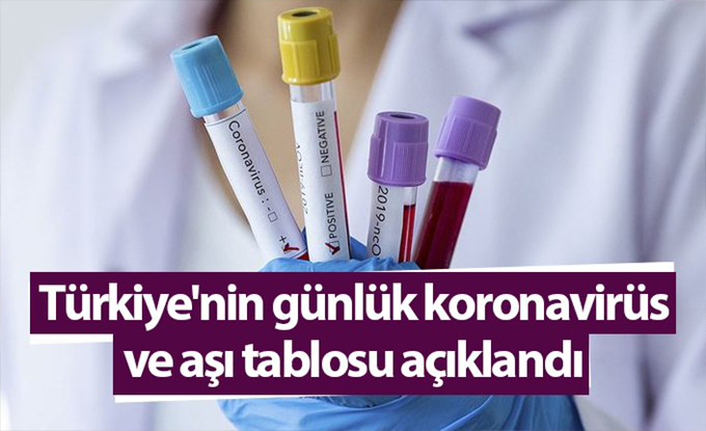 Türkiye’de son 24 saatte 1485 yeni Kovid-19 vakası tespit edildi