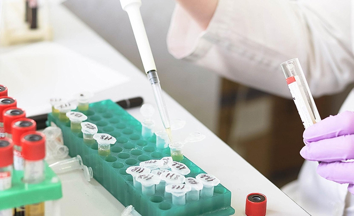 AB'de 8 ülkede 85 maymun çiçeği vakası