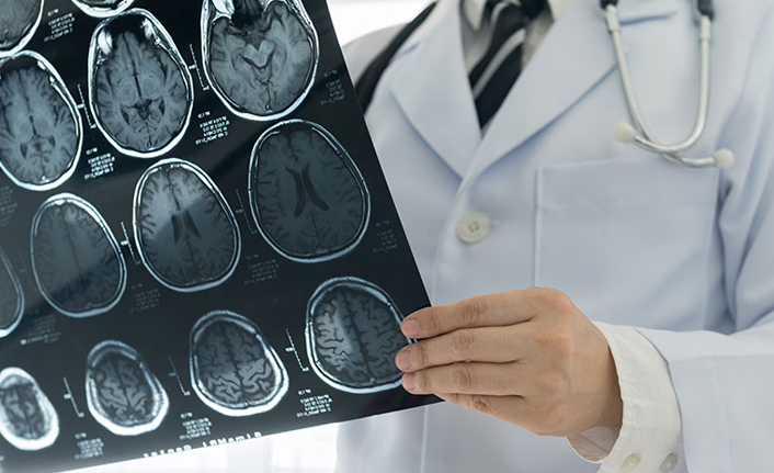 KTÜ'lü Profesörden önemli açıklama! "MS, tedavisi olmayan, çaresiz bir hastalık değildir"