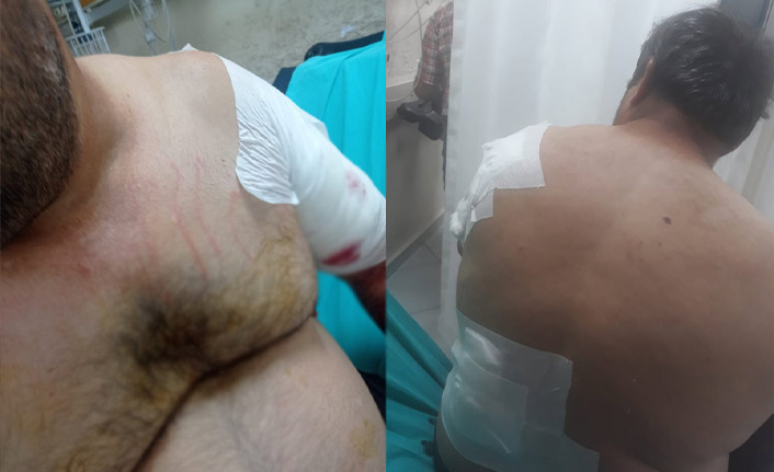 Kış uykusundan uyanan ayı vatandaşa saldırdı!