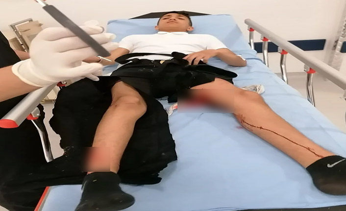 15 yaşındaki Efe sokak köpeklerinin saldırısına uğradı