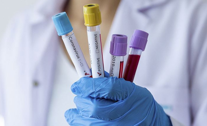 Koronavirüste 2 alt varyant sahnede! Daha hızlı bulaşıyor