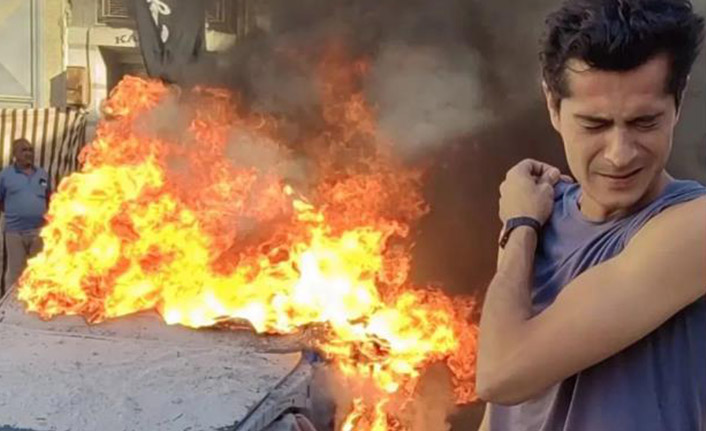 Sette kaza! Ünlü oyuncu İsmail Hacıoğlu yaralandı