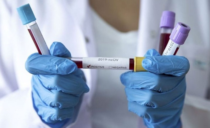 Haftalık Kovid-19 verileri açıklandı