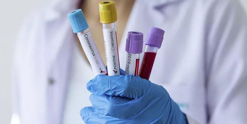 DSÖ'den koronavirüs açıklaması! "En düşük seviyede"