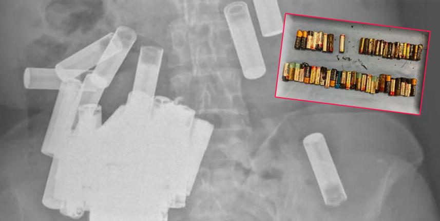 Ultrason istediler! Şaşkına uğradılar