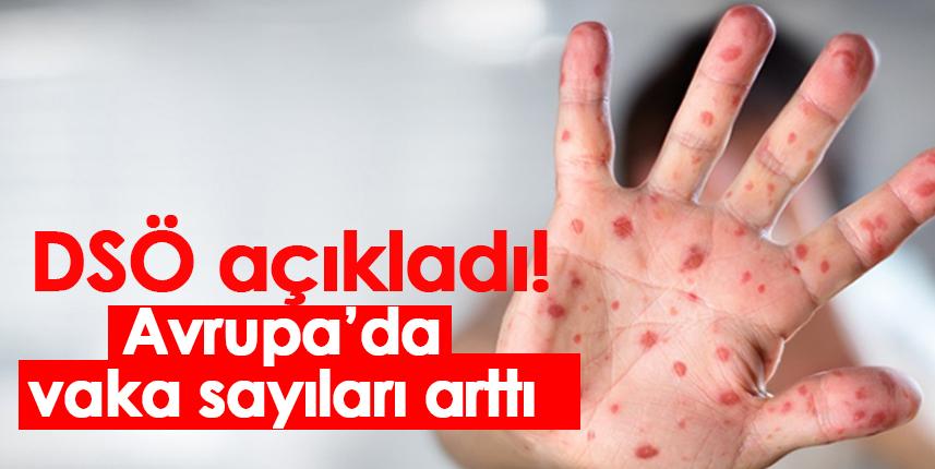 DSÖ açıkladı! Avrupa'da vaka sayıları arttı