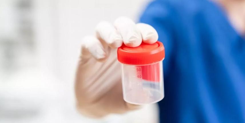 Sperm Testi! Sperm Testi Nasıl Yapılır?