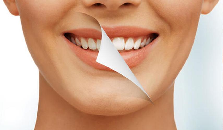 Bembeyaz dişlere sahip olmak için ne yapmak gerek? Sararmış dişlerinizden bu yöntemlerle kurtulun